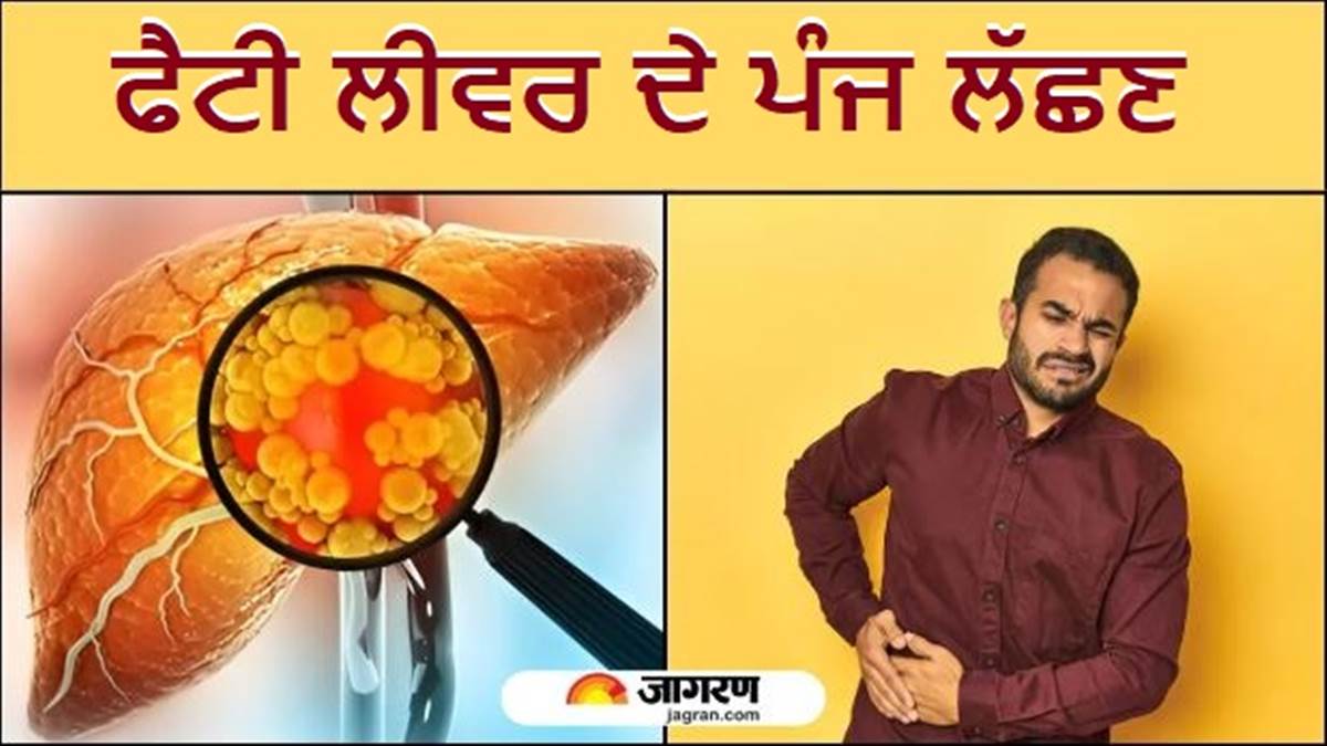 ਸਰੀਰ ਦੇ ਇਹ ਪੰਜ ਸੰਕੇਤ ਦੱਸਦੇ ਹਨ ਕਿ ਤੁਹਾਡਾ ਲਿਵਰ ਹੋ ਚੁੱਕਿਐ ਫੈਟੀ, ਅੱਜ ਹੀ ਘਰ ਬੈਠੇ ਕਰੋ ਪਛਾਣ