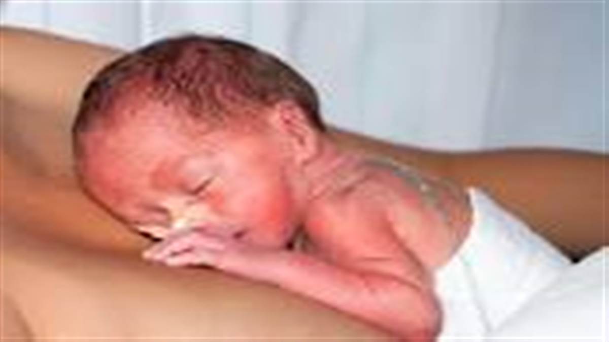 Mothers touch can protect a premature baby from infection revealed in a recent study