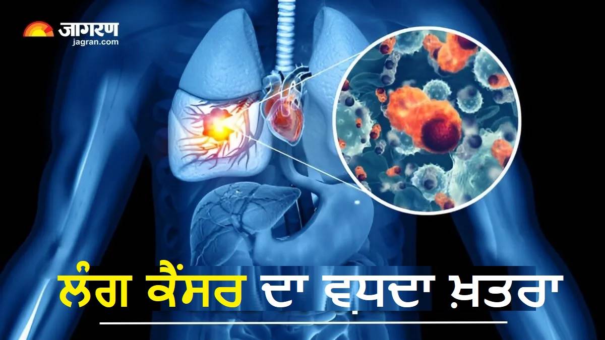 ਨਾਨ-ਸਮੋਕਰਜ਼ ਲਈ ਵੀ ਖ਼ਤਰੇ ਦੀ ਘੰਟੀ ! 2030 ਤਕ ਫੇਫੜਿਆਂ ਦਾ ਕੈਂਸਰ ਬਣੇਗਾ ‘ਸਾਇਲੈਂਟ ਕਿਲਰ’, ਨਵੀਂ ਸਟੱਡੀ ਨੇ ਖੋਲ੍ਹੀ ਡਰਾਉਣੀ ਸੱਚਾਈ