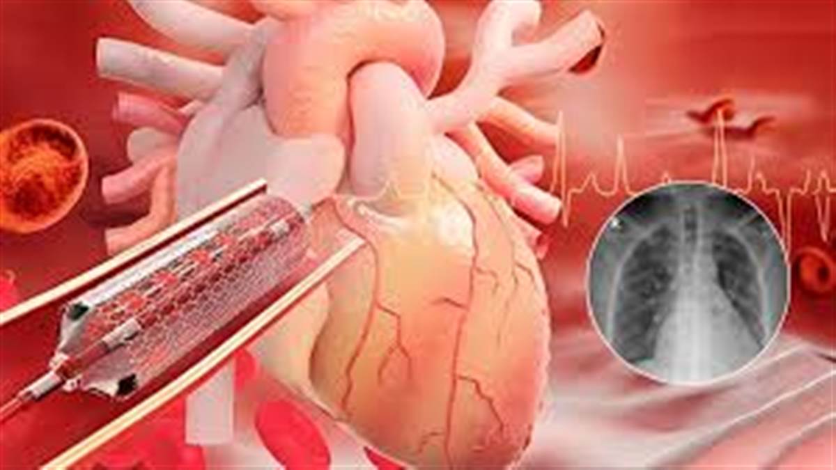 ਹਾਰਟ ਸਰਜਰੀ ਲਈ ਸਵੇਰ ਤੋਂ ਬਿਹਤਰ ਹੈ ਦੁਪਹਿਰ ਦਾ ਸਮਾਂ, ਖੋਜ 'ਚ ਜਾਣਕਾਰੀ ਆਈ ਸਾਹਮਣੇ