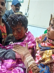 ਰੂਹ ਕੰਬਾਊ ਘਟਨਾ : ਖੇਤਾਂ ’ਚ ਪਤੰਗ ਲੁੱਟਣ ਵੜੇ ਬੱਚੇ ਨੂੰ ਕੁੱਤਿਆਂ ਨੇ ਬੁਰੀ ਤਰ੍ਹਾਂ ਨੋਚਿਆ, ਅੱਖ ਹੋਈ ਡੈਮੇਜ; PGI ਰੈਫਰ