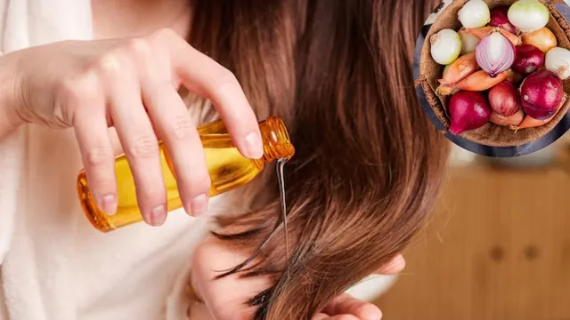 Hairfall ਰੋਕਣ ਲਈ ਘਰ 'ਚ ਬਣਾਓ ਪਿਆਜ਼ ਦਾ ਤੇਲ, ਮਹਿੰਗੇ ਟ੍ਰੀਟਮੈਂਟ ਦੀ ਨਹੀਂ ਪਵੇਗੀ ਲੋੜ