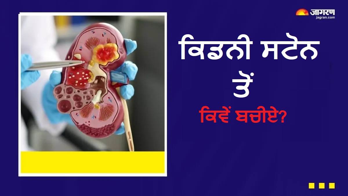 Health Tips : ਕੀ ਤੁਹਾਨੂੰ ਵੀ ਹੈ ਗੁਰਦੇ ਦੀ ਪੱਥਰੀ ਦੇ ਦੁਬਾਰਾ ਹੋਣ ਦਾ ਡਰ? 4 ਆਸਾਨ ਤਰੀਕਿਆਂ ਨਾਲ ਕਰੋ ਬਚਾਅ