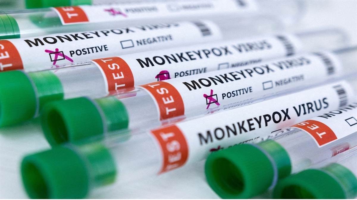 monkeypox is not gay disease people are not getting test done due to fear of stigma WHO warning |