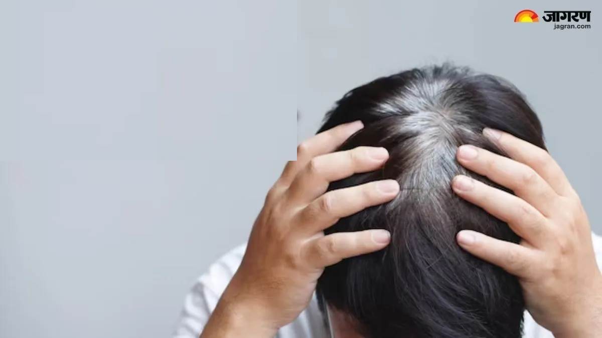 ਜਵਾਨੀ 'ਚ ਹੀ ਚਿੱਟੇ ਹੋ ਰਹੇ ਨੇ ਵਾਲ? ਸਾਵਧਾਨ! ਤੁਹਾਡੇ ਸਰੀਰ 'ਚ ਹੋ ਸਕਦੀ ਹੈ ਇਸ ਖ਼ਾਸ ਚੀਜ਼ ਦੀ ਘਾਟ