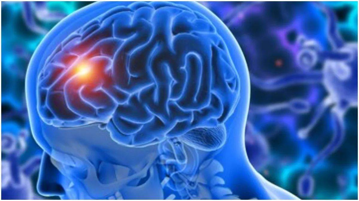 Brain Tumor Symptoms : ਬ੍ਰੇਨ ਟਿਊਮਰ ਹੋਣ 'ਤੇ ਦਿਸਦੇ ਹਨ ਇਹ ਗੰਭੀਰ ਲੱਛਣ, ਆਮ ਸਮਝ ਕੇ ਨਾ ਕਰਿਓ ਇਗਨੋਰ