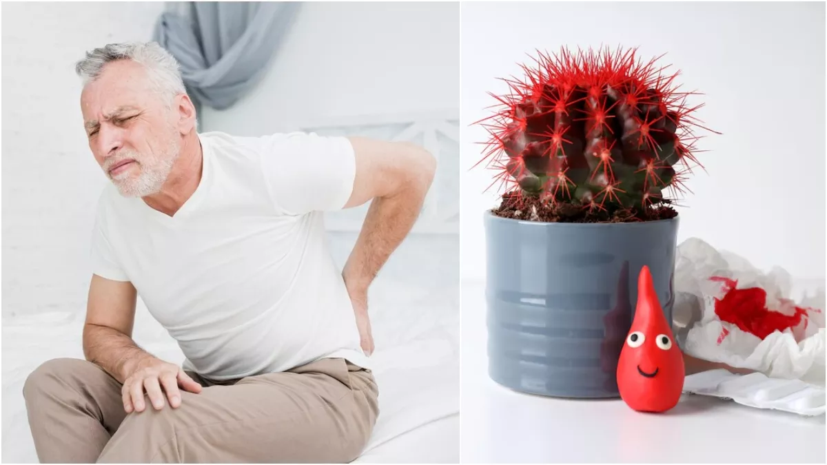 Piles Home Remedies : ਸ਼ਰਮਿੰਦਗੀ ਕਾਰਨ ਨਹੀਂ ਕਰਵਾ ਪਾ ਰਹੇ ਹੋ ਬਵਾਸੀਰ ਦਾ ਇਲਾਜ ਤਾਂ ਅਪਣਾਓ ਇਹ ਘਰੇਲੂ ਤਰੀਕੇ, ਜਲਦ ਦਿਸੇਗਾ ਅਸਰ