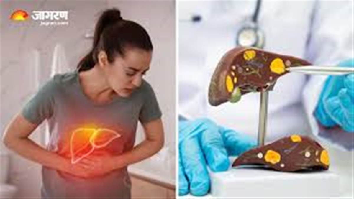 ਸਾਲ 2050 ਤੱਕ 180 ਕਰੋੜ ਲੋਕ ਹੋਣਗੇ ਫੈਟੀ ਲਿਵਰ ਦਾ ਸ਼ਿਕਾਰ, ਇਨ੍ਹਾਂ 5 ਕਾਰਨਾਂ ਕਰ ਕੇ ਵਧ ਰਿਹੈ ਬਿਮਾਰੀ ਦਾ ਖ਼ਤਰਾ