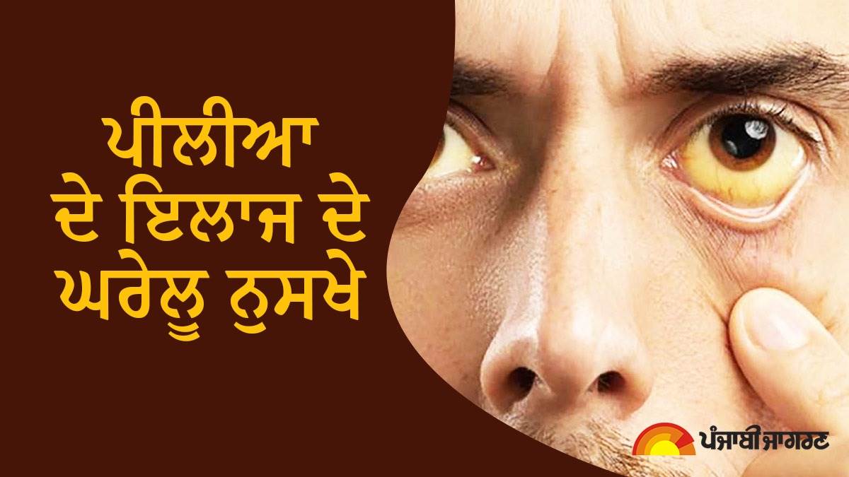 Jaundice Treatment : ਪੀਲੀਏ ਤੋਂ ਮਿਲੇਗਾ ਜਲਦ ਛੁਟਕਾਰਾ, ਬਸ ਅਜ਼ਮਾਓ ਇਹ 6 ਉਪਾਅ