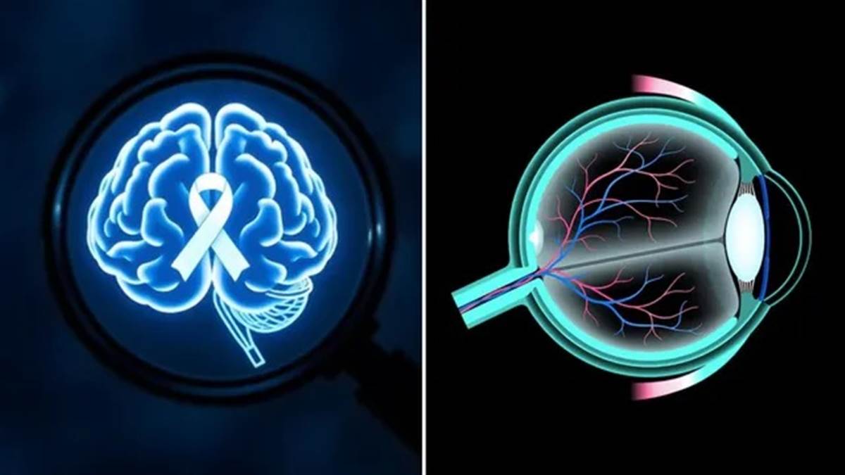 ਕੀ ਅੱਖਾਂ ਦੀ ਜਾਂਚ ਤੋਂ ਕਈ ਸਾਲ ਪਹਿਲਾਂ ਹੀ ਲੱਗ ਸਕੇਗਾ ਅਲਜ਼ਾਈਮਰ ਦਾ ਪਤਾ? ਵਿਗਿਆਨੀਆਂ ਨੇ ਜਗਾਈ ਉਮੀਦ