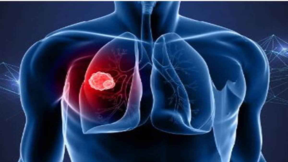 Research News : ਕੈਂਸਰ ਕੋਸ਼ਕਾਵਾਂ ਨੂੰ ਤਬਾਹ ਕਰਨ ’ਚ ਕਾਰਗਰ ਸਾਬਤ ਹੋਵੇਗਾ ਇਕ ਵਿਸ਼ੇਸ਼ ਪ੍ਰੋਟੀਨ