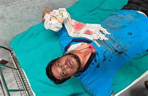 Barnala Crime : ਮਾਮੂਲੀ ਤਕਰਾਰ ਨੂੰ ਲੈ ਕੇ ਗੁੰਡਾਗਰਦੀ ਦਾ ਨੰਗਾ ਨਾਚ, ਕਾਰ ਦੀ ਭੰਨ-ਤੋੜ ਤੋਂ ਬਾਅਦ ਨੌਜਵਾਨ ਕੀਤਾ ਲਹੂ-ਲੁਹਾਣ; ਇਲਾਕੇ ਅੰਦਰ ਫੈਲੀ ਸਨਸਨੀ