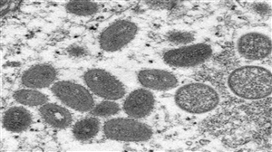 WHO on Monkeypox : Monkeypox ਨੂੰ ਲੈ ਕੇ ਐਲਾਨ ਹੋ ਸਕਦੀ ਹੈ ਗਲੋਬਲ ਐਮਰਜੈਂਸੀ, WHO ਕਰੇਗਾ ਫੈਸਲਾ