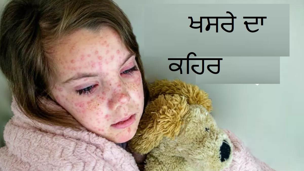 WHO: ਸਾਲ ਦੇ ਅੰਤ ਤੱਕ ਅੱਧੀ ਤੋਂ ਵੱਧ ਦੁਨੀਆ ਖਸਰੇ ਦੇ ਖ਼ਤਰੇ ’ਚ, ਇਨ੍ਹਾਂ ਤਰੀਕਿਆਂ ਨਾਲ ਕਰੋ ਆਪਣਾ ਬਚਾਅ