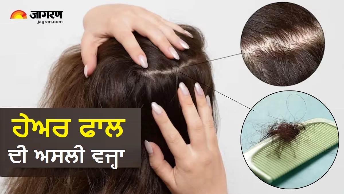 ਸਰਦੀਆਂ 'ਚ ਕਿਉਂ ਜ਼ਿਆਦਾ ਝੜਨ ਲੱਗਦੇ ਹਨ ਵਾਲ ? ਨਿਊਟ੍ਰਿਸ਼ਨਿਸਟ ਨੇ ਦੱਸਿਆ ਕਿਹੜੀਆਂ 3 ਕਮੀਆਂ ਨੂੰ ਦੂਰ ਕਰਨਾ ਹੈ ਜ਼ਰੂਰੀ