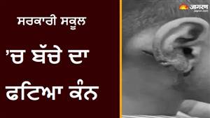 ਚੰਡੀਗੜ੍ਹ ਦੇ ਸਰਕਾਰੀ ਸਕੂਲ ’ਚ ਬੱਚੇ ਦਾ ਫਟਿਆ ਕੰਨ, ਅਧਿਆਪਕ ਬੋਲੇ- ਪੌੜੀਆਂ ਤੋਂ ਡਿੱਗਿਆ, ਪਰਿਵਾਰ ਨੇ ਲਾਏ ਮਾਰਕੁੱਟ ਦੇ ਦੋਸ਼