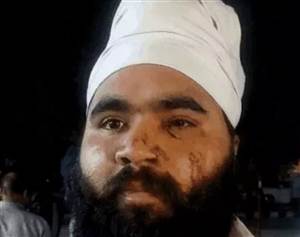 ਸਾਬਕਾ ਕਾਂਗਰਸੀ ਨੇਤਾ ’ਤੇ ਤਾਬੜਤੋੜ ਫਾਇਰਿੰਗ, ਦਾਤਰ ਨਾਲ ਕੱਟੇ ਵਾਲ; ਮਾਂ ਤੇ ਢਾਈ ਸਾਲ ਦੇ ਬੇਟੇ ਦੇ ਸਾਹਮਣੇ ਦਿੱਤਾ ਵਾਰਦਾਤ ਨੂੰ ਅੰਜਾਮ