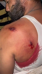 Amritsar News: ਭਿੱਟੇਵੱਡ ਪਿੰਡ 'ਚ ਗੋਲੀਬਾਰੀ ਦੀ ਘਟਨਾ, ਨਸ਼ਾ ਵੇਚਣ ਤੋਂ ਰੋਕਣ ਦੀ ਕੋਸ਼ਿਸ਼ ਕਰਨ 'ਤੇ ਇੱਕ ਨੌਜਵਾਨ ਨੂੰ ਮਾਰੀ ਗੋਲੀ