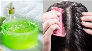 Hair Care Tips : ਡੈਂਡਰਫ ਦੀ ਕਰਨਾ ਚਾਹੁੰਦੇ ਹੋ ਛੁੱਟੀ ਤਾਂ ਇਨ੍ਹਾਂ ਤਰੀਕਿਆਂ ਨਾਲ ਕਰੋ ਐਲੋਵੇਰਾ ਦਾ ਇਸਤੇਮਾਲ