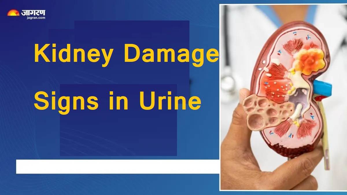 ਪਿਸ਼ਾਬ 'ਚ ਨਜ਼ਰ ਆਉਂਦੇ ਹਨ ਕਿਡਨੀ ਡੈਮੇਜ ਦੇ ਸੰਕੇਤ; ਜੇ ਦਿਖਾਈ ਦੇਣ 5 ਬਦਲਾਅ ਤਾਂ ਤੁਰੰਤ ਜਾਓ ਡਾਕਟਰ ਕੋਲ