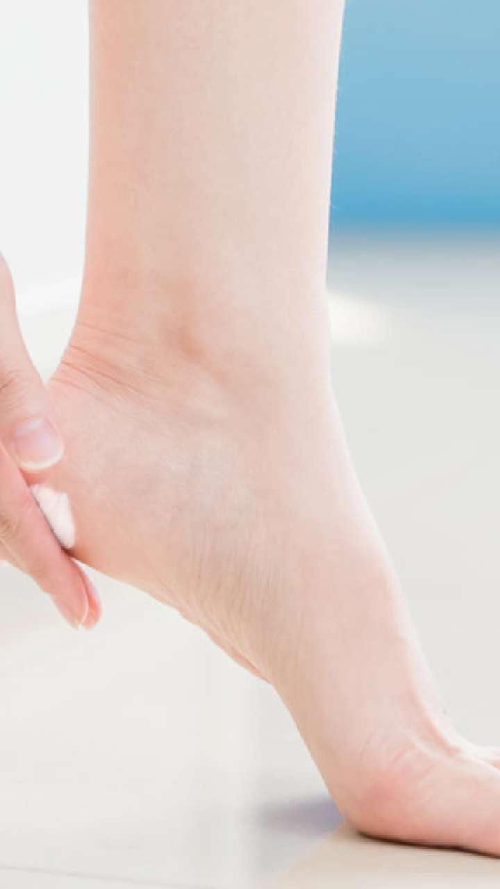 Natural Remedy For Cracked Heels? A Pinterest Experiment! - Fun Things To  Do While You're Waiting