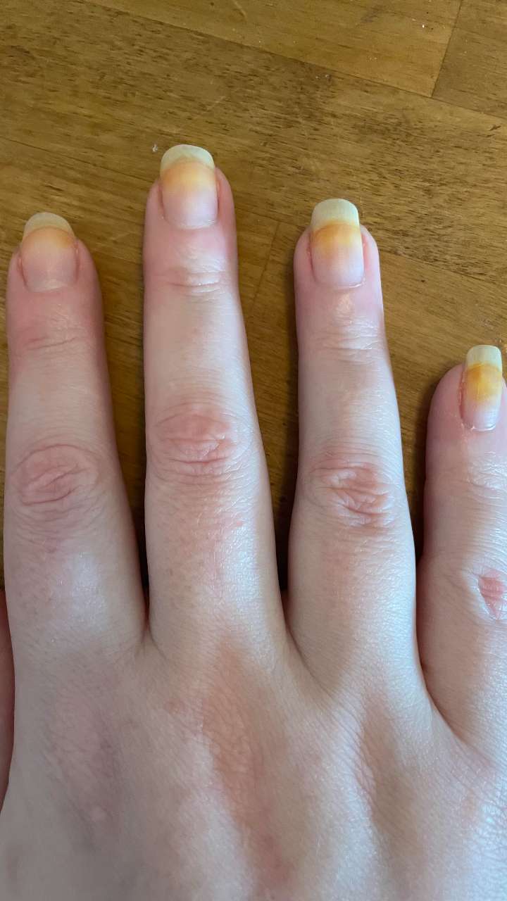 Poly gel turned yellow straight after curing, bad poly gel? : r/Nails