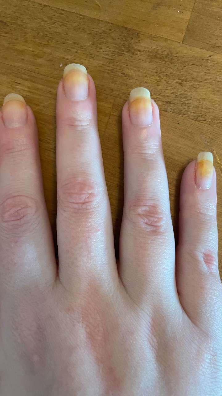Startling Reasons Why Your Nails Turn Yellow | Polish and Pearls